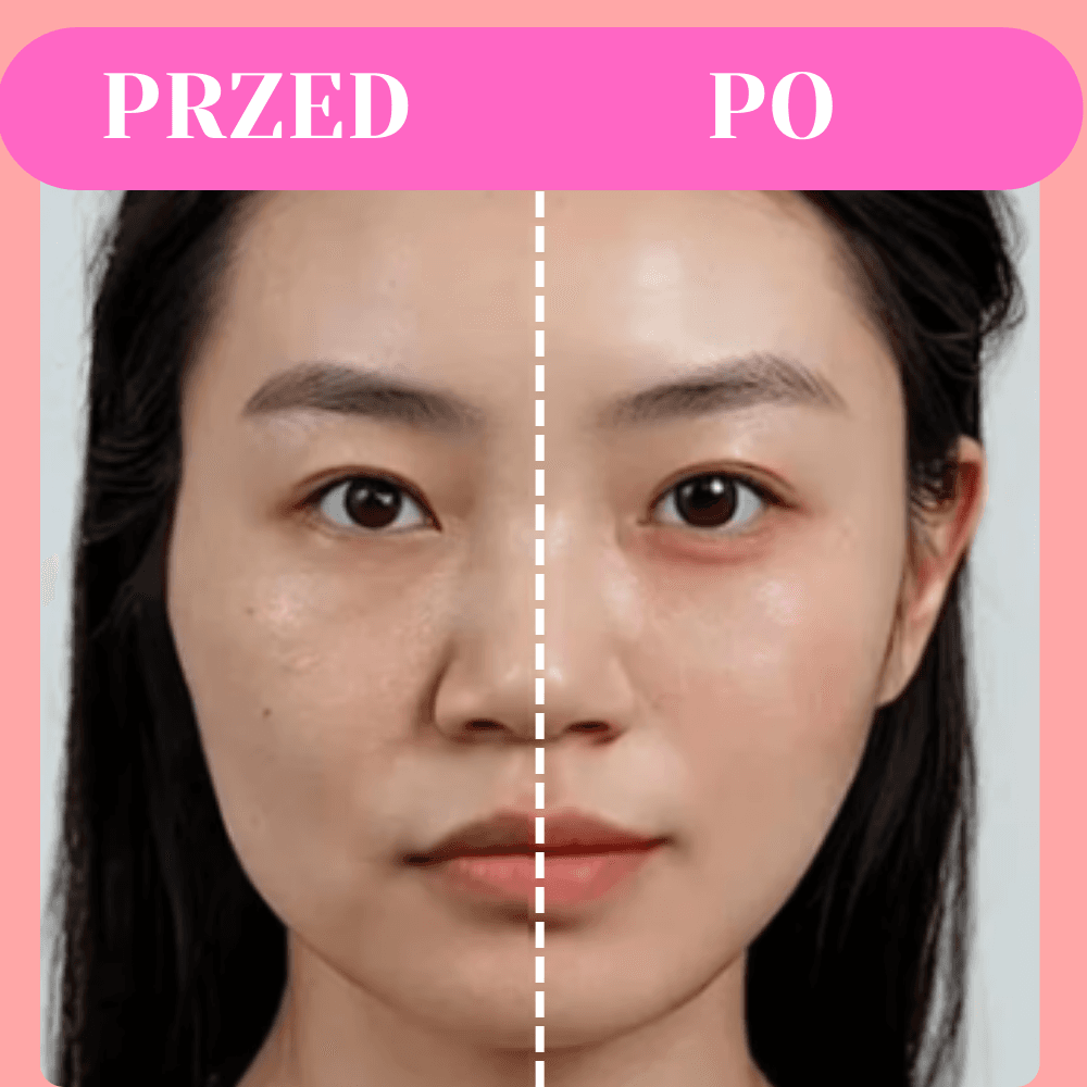 LumiFace - Masażer limfatyczny do twarzy